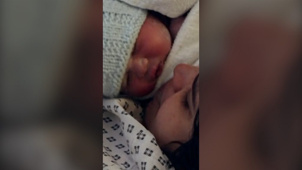 1 in 4 births in England now by emergency C-section