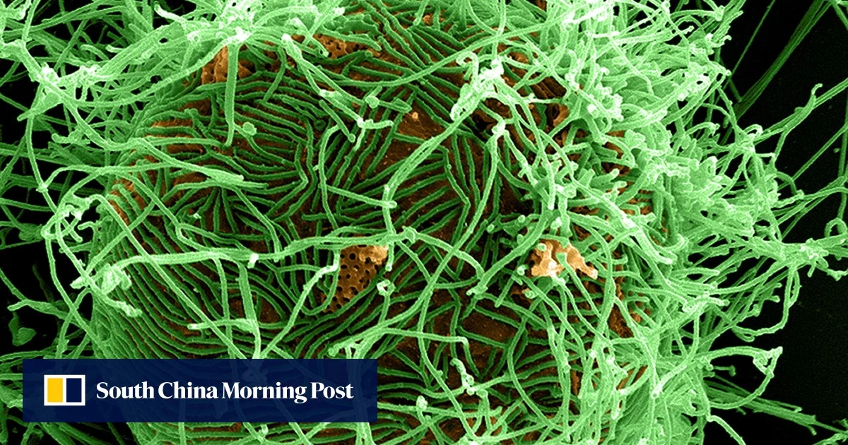 US to screen for Ebola at airports, one American in DR Congo infected