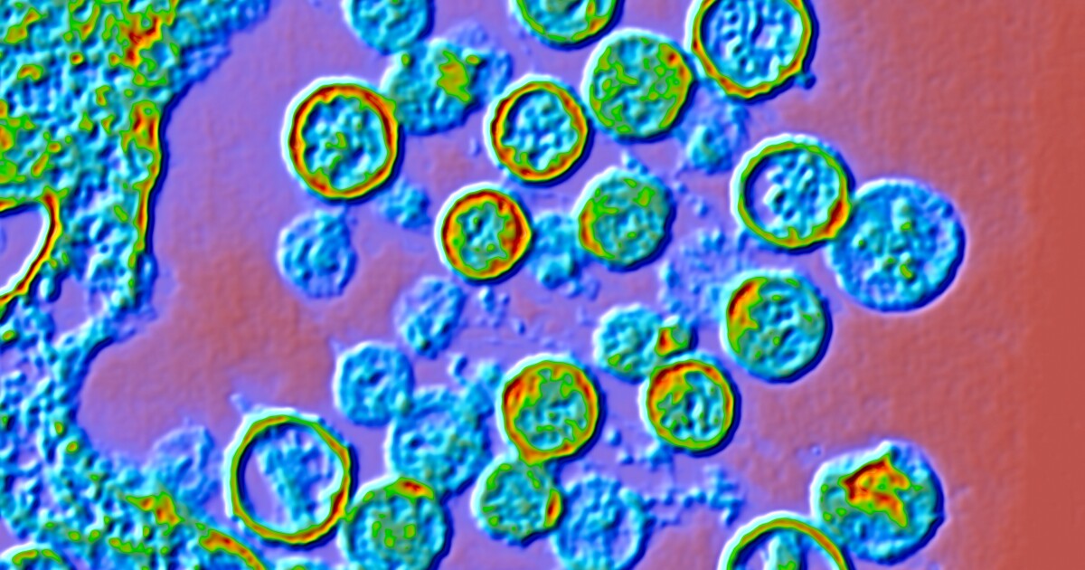Is hantavirus the next COVID? Is the U.S. response on point? An outbreak update