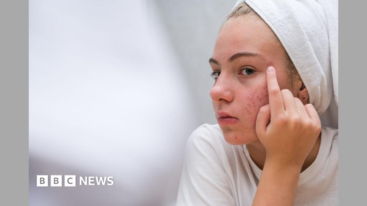 The simple skincare routine for teens that actually works - and five expert tips