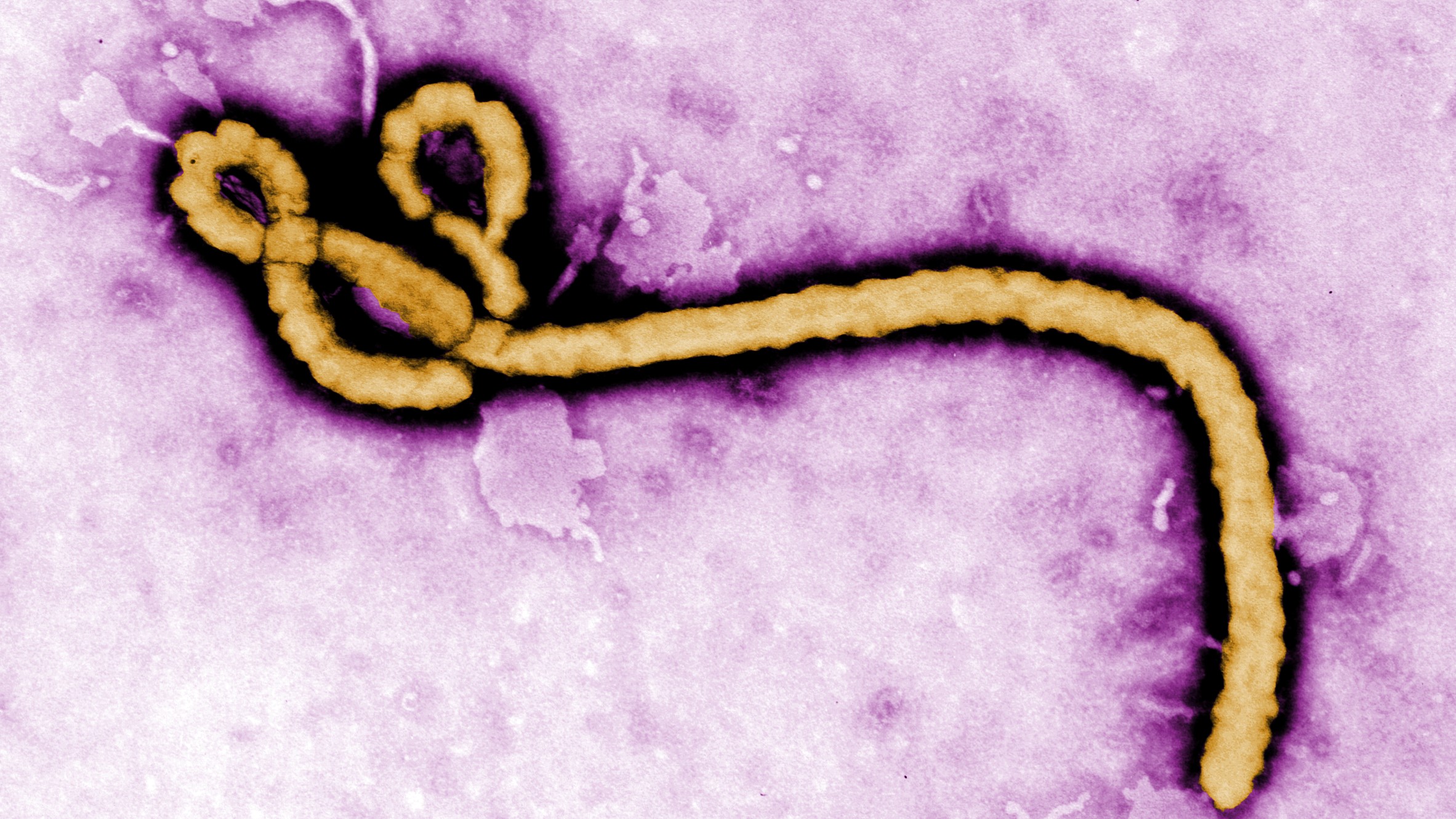 Ebola Disease: Current Situation