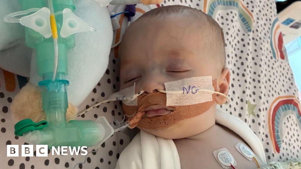 Baby can't access lifesaving treatment