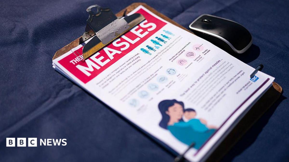 US measles cases reach 35-year high