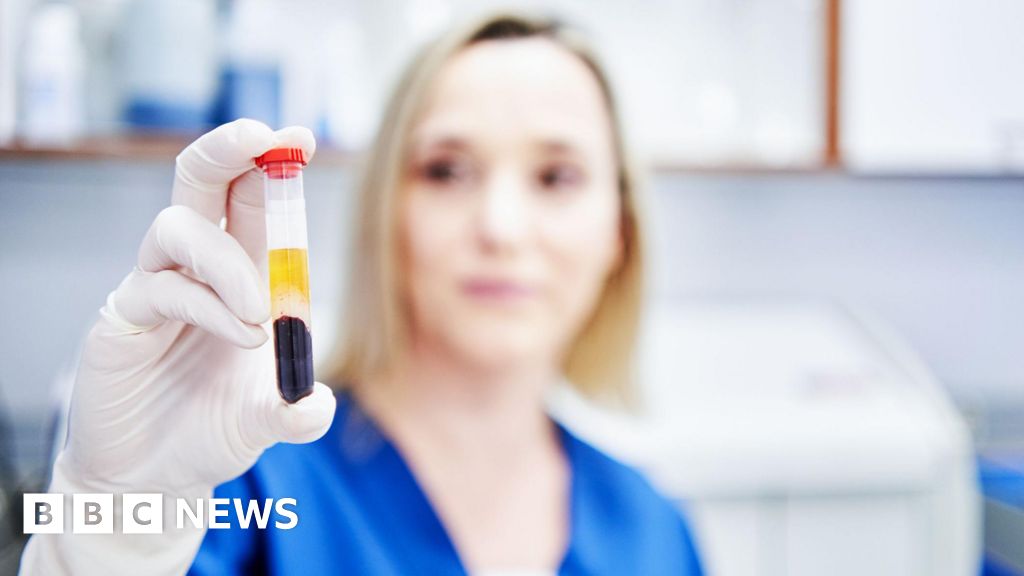 Multi-cancer blood test missed key goal in NHS trial