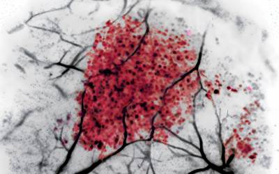 Microplastics mapped in living tissue for the first time