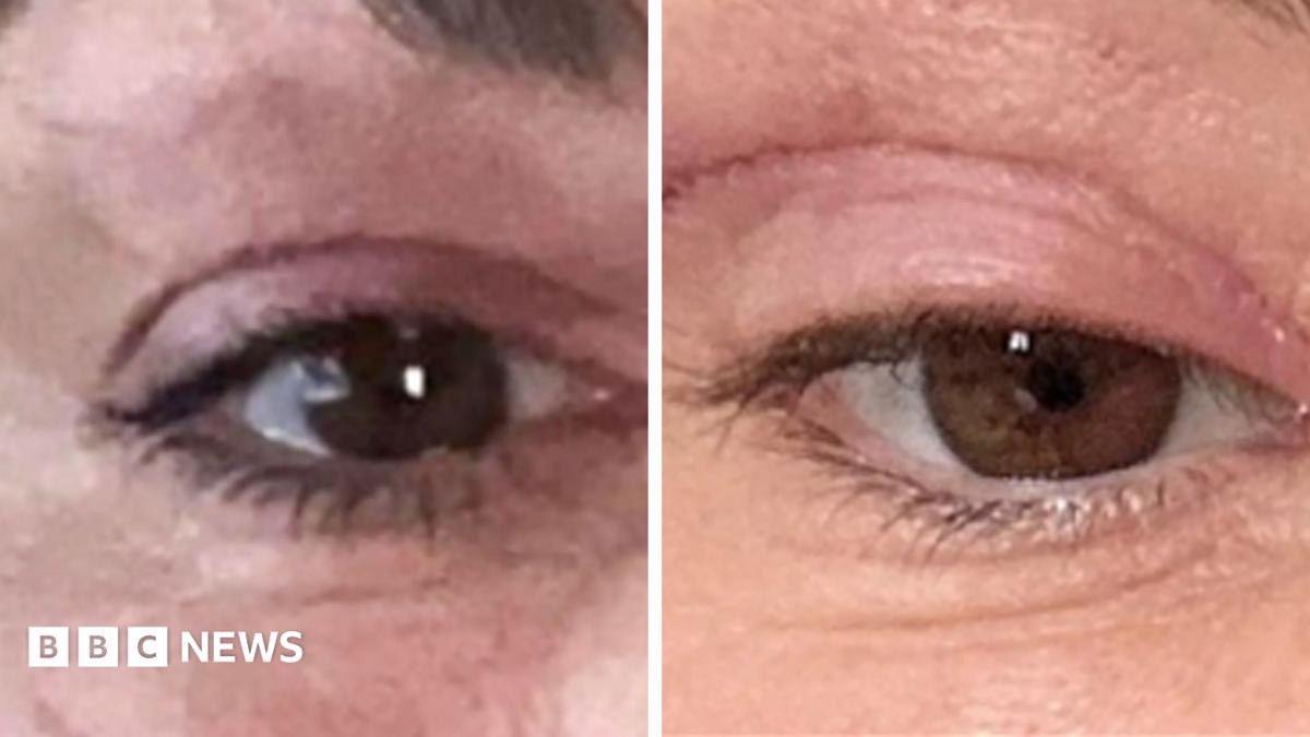 'My eyelids became infected - I was scared to sleep'