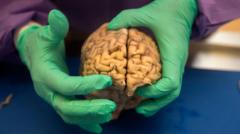 Brain disease in dead NFL players 'higher than previously shown'